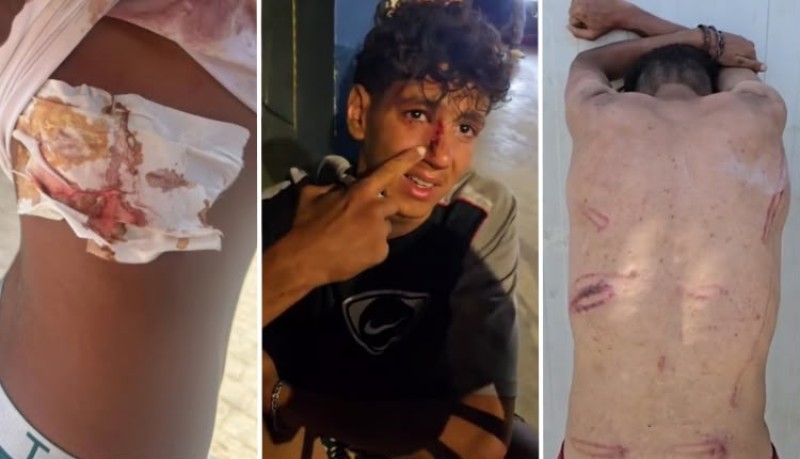 تقارير حقوقية تفضح انتهاكات الأمن الاسباني في سبتة بصور ومقاطع فيديو وثقت ممارسات الشرطة