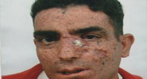 السرطان ينهش جلد \"عندليب الجزائر\" ويلزمه الفراش 6 سنوات
