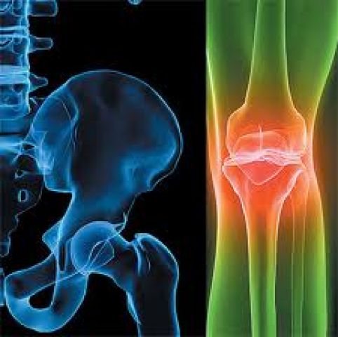 الجزائر لا تغطي علاج المصابين بداء الروماتيزم إلا بنسبة 3 بالمائة