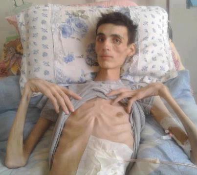 المختار شاب في العشرينات في حاجة ماسة الى مساعدة