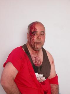 مستثمر مغربي دنمركي يتعرض للضرب من بلطجية السلطة في دولة القوق والبرقوق