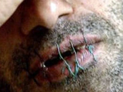 مهاجرون مغاربة يخيطون افواههم احتجاجا على احتجازهم في ايطاليا