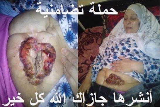 لذوي القلوب الرحيمة لكل من يريد أن ينال أجرا عظيما