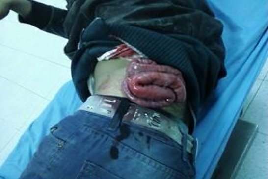 الحقوقي كمال الدين فخار  يصف أحداث غرداية بالتطهير العرقي ضد الأمازيغ