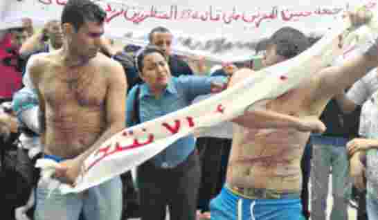 ارتفاع "مقلق" لحالات الانتحار في الجزائر