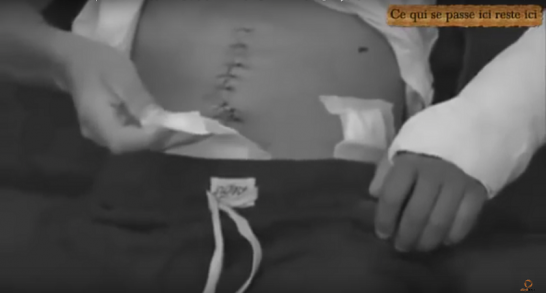 الظلم و الحقرة في الجزائر شاب جزائري تلقى 6 رصاصات من طرف مستشار رئيس الجمهورية
