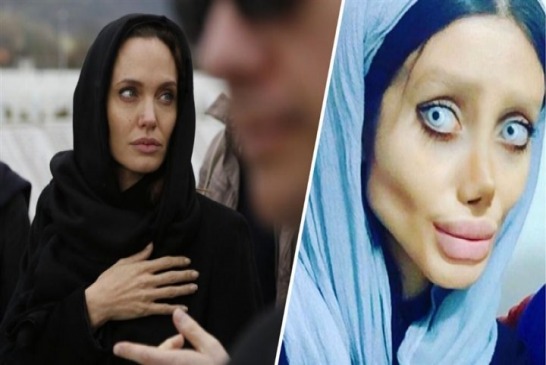 هكذا أصبحت فتاة إيرانية بعدما أجرت 50 عملية تجميل لتشبه “أنجلينا جولي”!