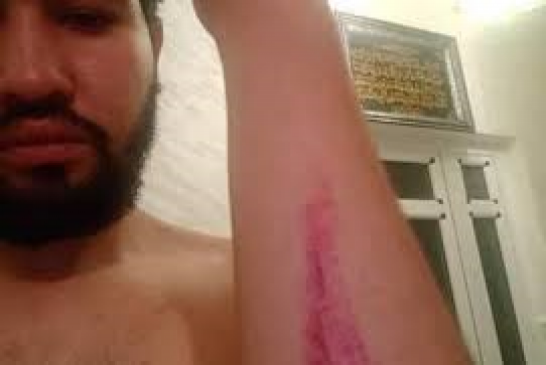 Un jeune journaliste brutalisé dans un commissariat à Annaba