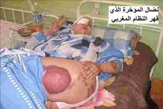 وكالة الأنباء الجزائرية تخصص مساحة "لسليطينة خيا" وتغض الطرف على جرائم الجيش الجزائري بمخيمات تندوف