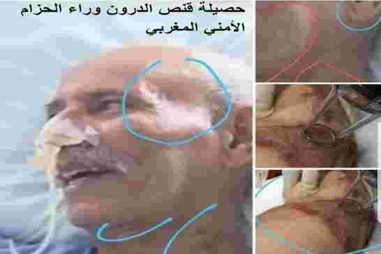 بن بطوش بهدل بسيادة وصمعة البلاد بعد رفض إسبانيا دخول طائرة رئاسية جزائرية لنقله